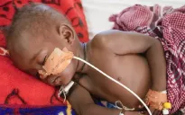 Giao tranh ở Nam Sudan chặn viện trợ dinh dưỡng cho 60.000 trẻ em