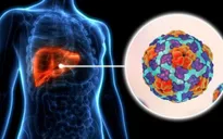 Số ca tăng vọt, Los Angeles (Mỹ) tuyên bố bùng phát dịch viêm gan A