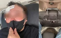 Dùng gậy sắt chọc vào mặt người phụ nữ do mâu thuẫn giao thông ở Hà Nội