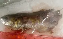 Cá rô đồng sống chui vào họng bé trai 4 tuổi, bác sĩ cấp cứu khẩn