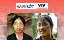 Đoàn Thanh niên Đài Truyền hình Việt Nam chính thức đồng hành cùng "Xóa 'bớt' cho em"