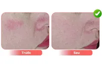 Giải pháp cho da tiền lão hóa độ tuổi từ 40 đến 50 tuổi