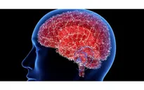 Từ trường có thể giúp ngăn chặn bệnh Alzheimer