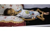 Liên hợp quốc: Khủng hoảng suy dinh dưỡng ở trẻ em Gaza chạm mức kỷ lục