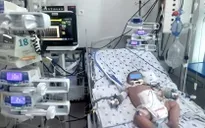 Cứu sống trẻ 7 tháng tuổi sốc sốt xuất huyết nặng, rối loạn đông máu