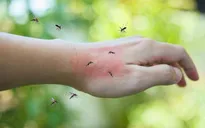 Khí hậu ấm lên khiến mùa muỗi ở Hàn Quốc kéo dài bất thường