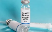 Giới chức y tế Mỹ kêu gọi tách riêng mũi vaccine kết hợp sởi, quai bị và Rubella