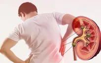 10 triệu người sống chung với bệnh thận mạn tính, gánh nặng từ việc phát hiện muộn