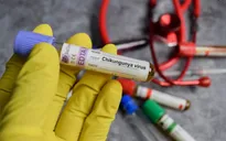 New York (Mỹ) xác nhận trường hợp nhiễm virus Chikungunya đầu tiên 