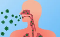 Bộ Y tế: Tăng cường phòng, chống cúm mùa, virus hợp bào hô hấp và tay chân miệng