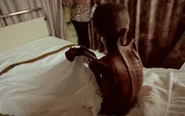 Phương Tây cắt giảm viện trợ có thể khiến hơn 22 triệu người tử vong