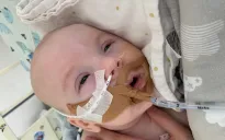 Bùng phát tình trạng ngộ độc botulinum ở trẻ sơ sinh tại Mỹ