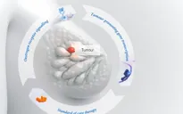 Thuốc uống thử nghiệm giúp giảm nguy cơ tái phát ung thư vú