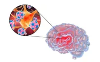 Nguy hiểm: Số ca mắc bệnh do não mô cầu đang tăng mạnh