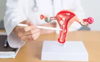 Tháng Nâng cao nhận thức về ung thư cổ tử cung: Căn bệnh có thể phòng ngừa