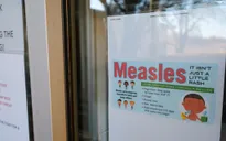 Mỹ xác nhận ít nhất 171 trường hợp mắc sởi tại 9 bang 