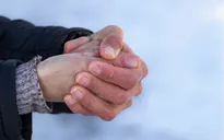 Bỏng lạnh có thể xảy ra ở miền Bắc không?