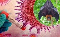 Chuyên gia nói gì về virus Nipah?