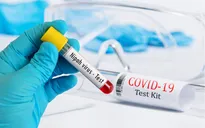 So sánh virus Nipah và SARS-CoV-2: Khác biệt nào đáng lo ngại hơn? 