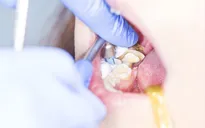 TP Hồ Chí Minh: Tăng cường quản lý lĩnh vực nha khoa để bảo đảm an toàn cho người dân