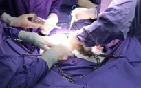 Mang dị vật kim loại trong bụng suốt 2 tháng