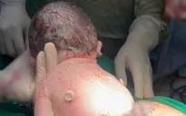 Khoảnh khắc đẹp tuần qua (23-29/3): “Đôi cánh nhỏ” và hành trình giữ lại sự sống