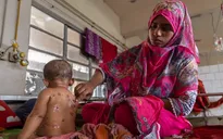 Dịch sởi bùng phát khiến ít nhất 15 người thiệt mạng ở Bangladesh 