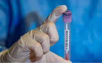 Quốc gia trải qua đợt bùng phát hantavirus kỷ lục 