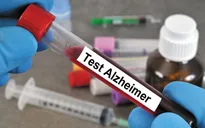 Mỹ phát triển phương pháp xét nghiệm máu giúp phát hiện sớm bệnh Alzheimer