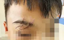 Nguy hiểm tai nạn thương tích ở trẻ em dịp nghỉ hè