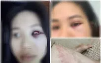 Thầy giáo THPT bị tố có con riêng, bạo hành vợ: Công an vào cuộc xác minh