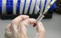Phát hiện protein mới ngăn chặn virus HIV