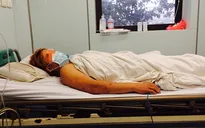 Cẩn thận nhầm lẫn Viêm não mô cầu với bệnh khác