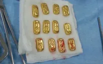 Phát hiện 12 thỏi vàng trong bụng doanh nhân Ấn Độ