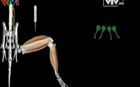 Liệu pháp ánh sáng chữa bệnh thần kinh vận động