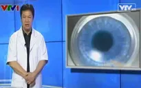 Sau khi mổ cận thị, có được bơi lội không?