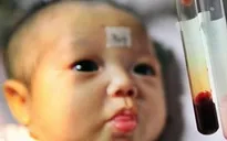 Những trường hợp nên đưa trẻ đi xét nghiệm máu