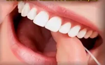 Có thể chỉnh răng ở mọi độ tuổi