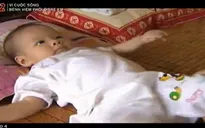 Viêm phổi - Bệnh nguy hiểm ở trẻ nhỏ