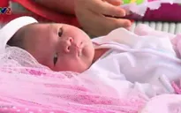 Những bệnh thường gặp ở trẻ sơ sinh
