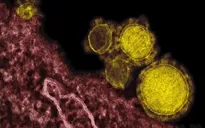 Singapore công bố nỗ lực ngăn chặn MERS