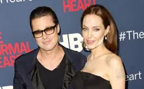Những vệt trắng loang lổ trên mặt Angelina Jolie: Là thật hay do photoshop?