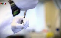 Tách virus HIV khỏi tế bào người