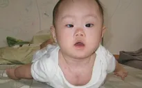 Nguy hiểm bệnh lý nhược cơ