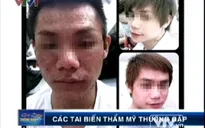 Tiêm thuốc tắm trắng: Coi chừng biến chứng