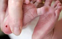 Nâng cao sàng lọc trước sinh và sàng lọc sơ sinh