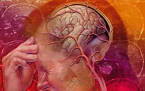 Giảm đau do căn nguyên thần kinh - Cách gì?