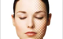 Sẹo và các dạng thuốc điều trị