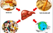 Cần phát hiện và điều trị sớm bệnh gan nhiễm mỡ