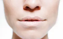 Dưỡng ẩm đôi môi khô nứt